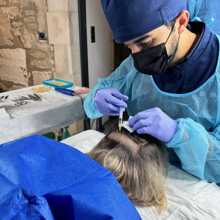 prélèvement en vue d'une greffe de sourcils par le dr ghali en france a saint remy de provence